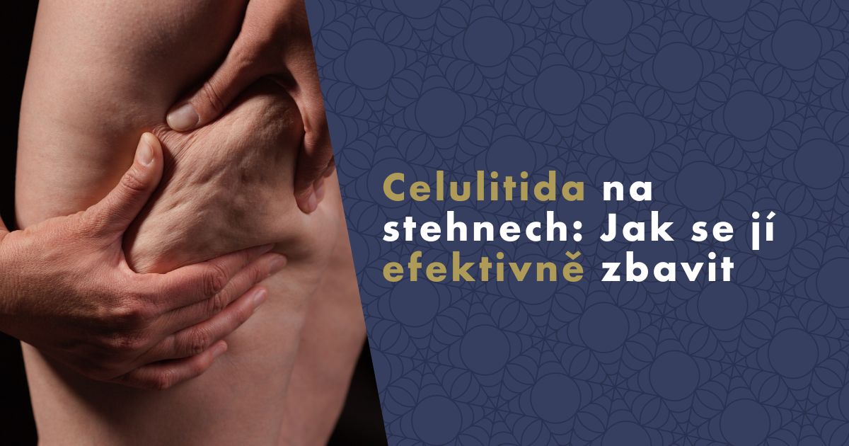 celulitida-na-stehnech-fb